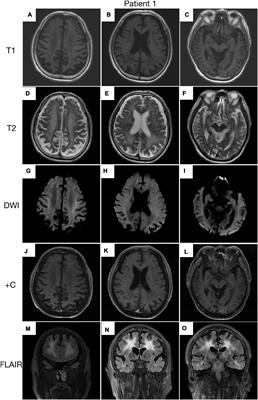 Clinical characteristics of two patients with neuronal intranuclear inclusion disease and literature review